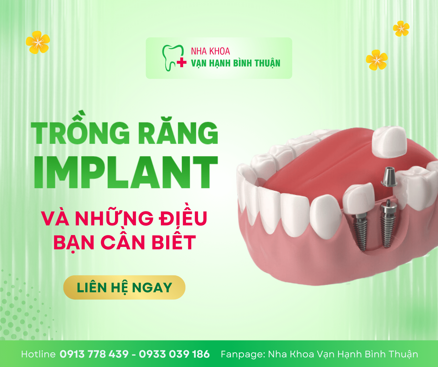Trồng răng Implant