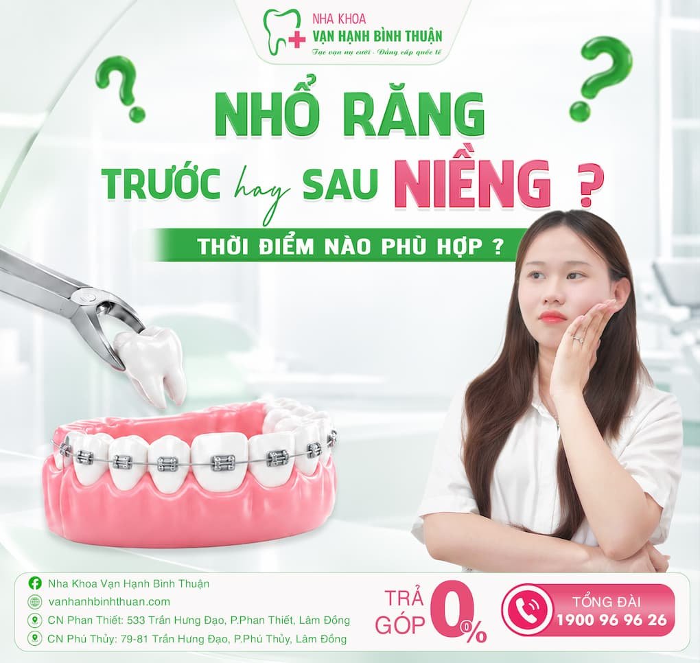Poster Nhổ răng sau khi niềng