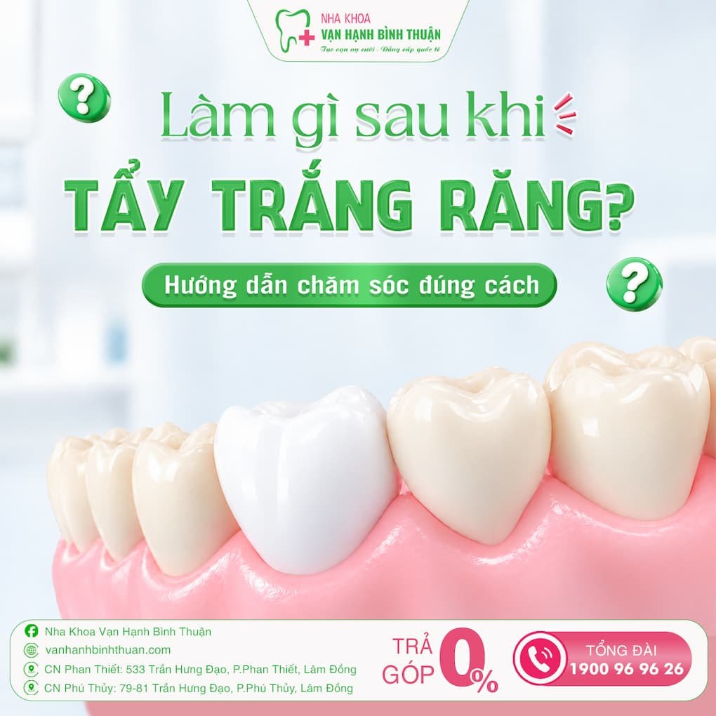 làm gì sau khi tẩy trắng răng