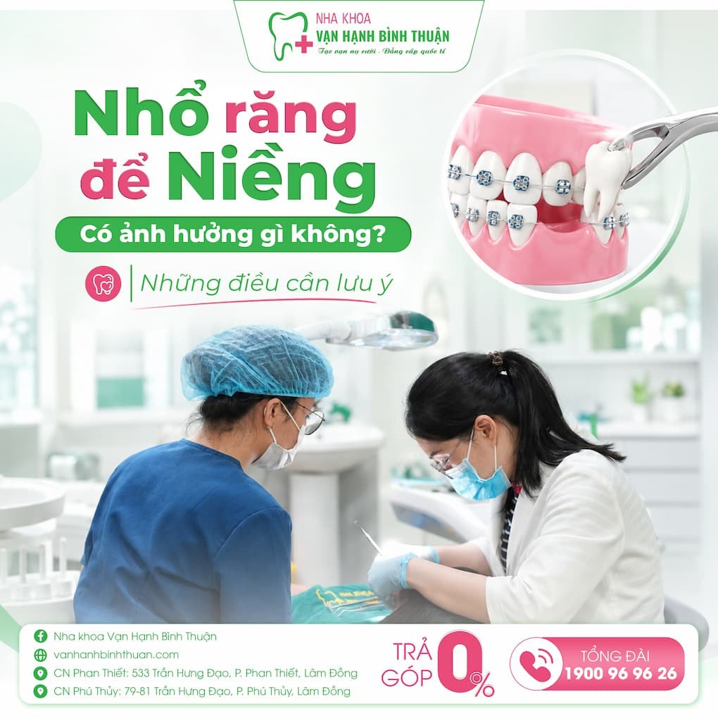 Nhổ răng để niềng
