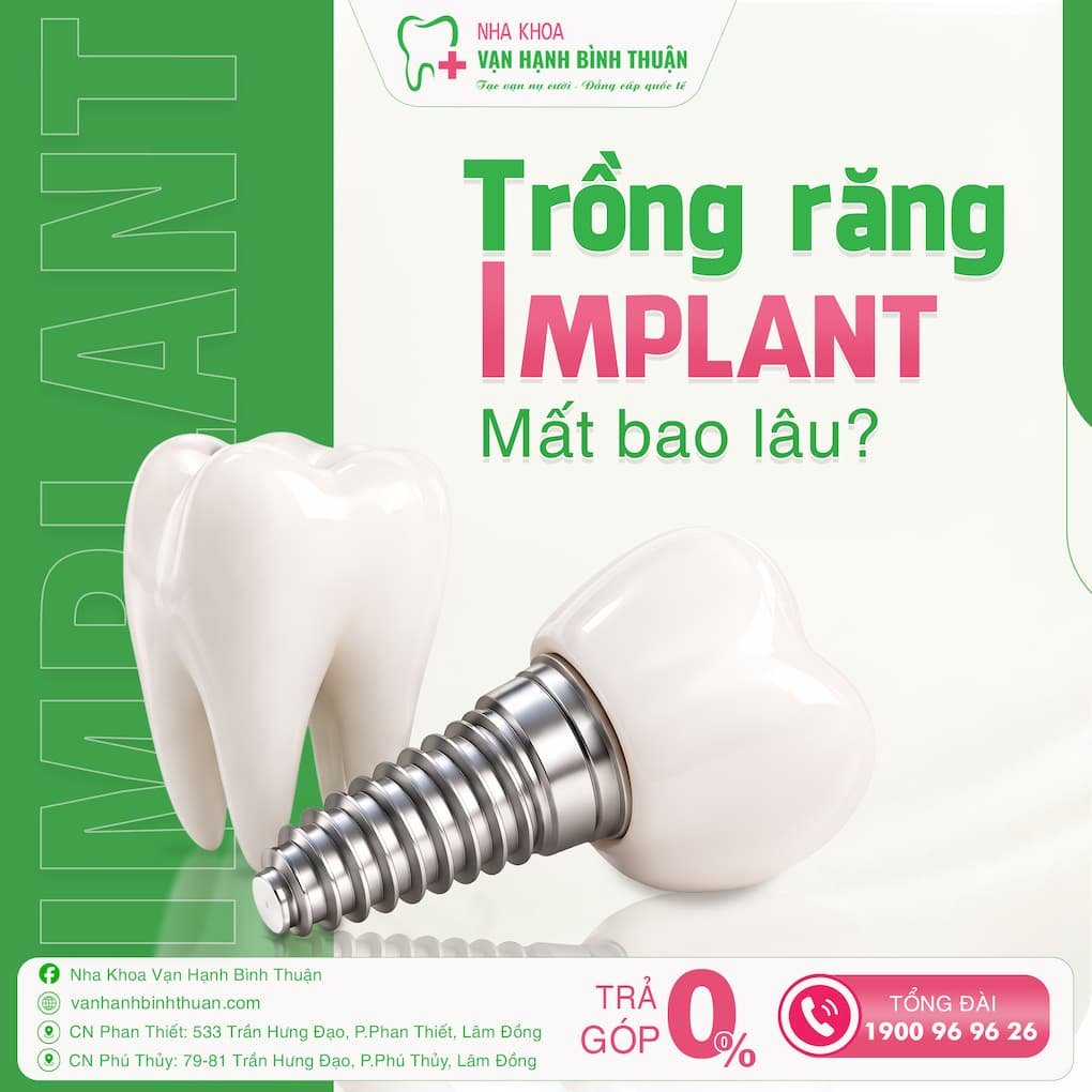quy trình trồng răng implant mất bao lâu