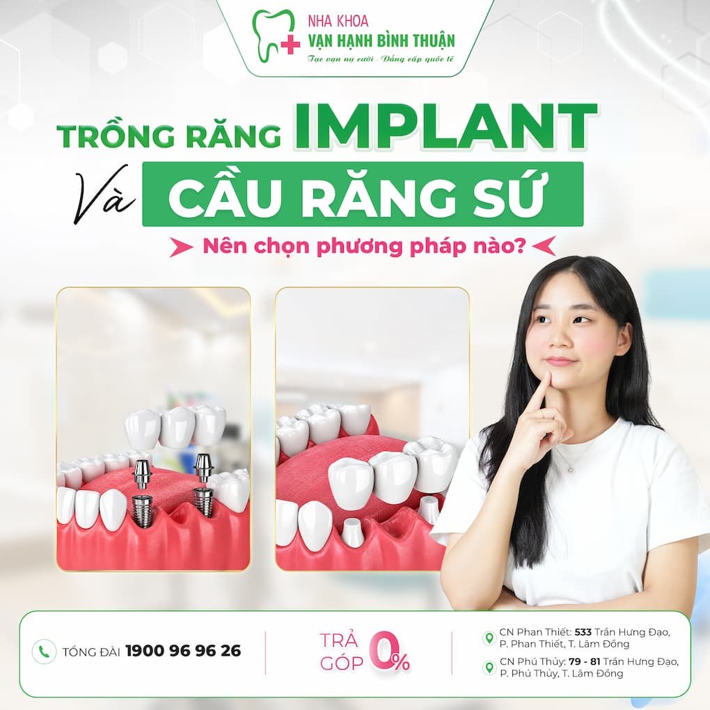 trồng răng implant và cầu răng sứ
