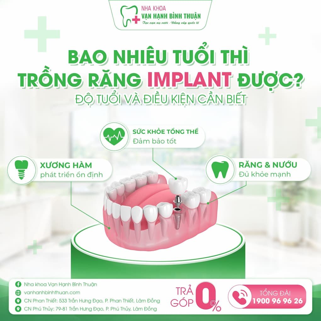 bao nhiêu tuổi thì trồng răng implant được