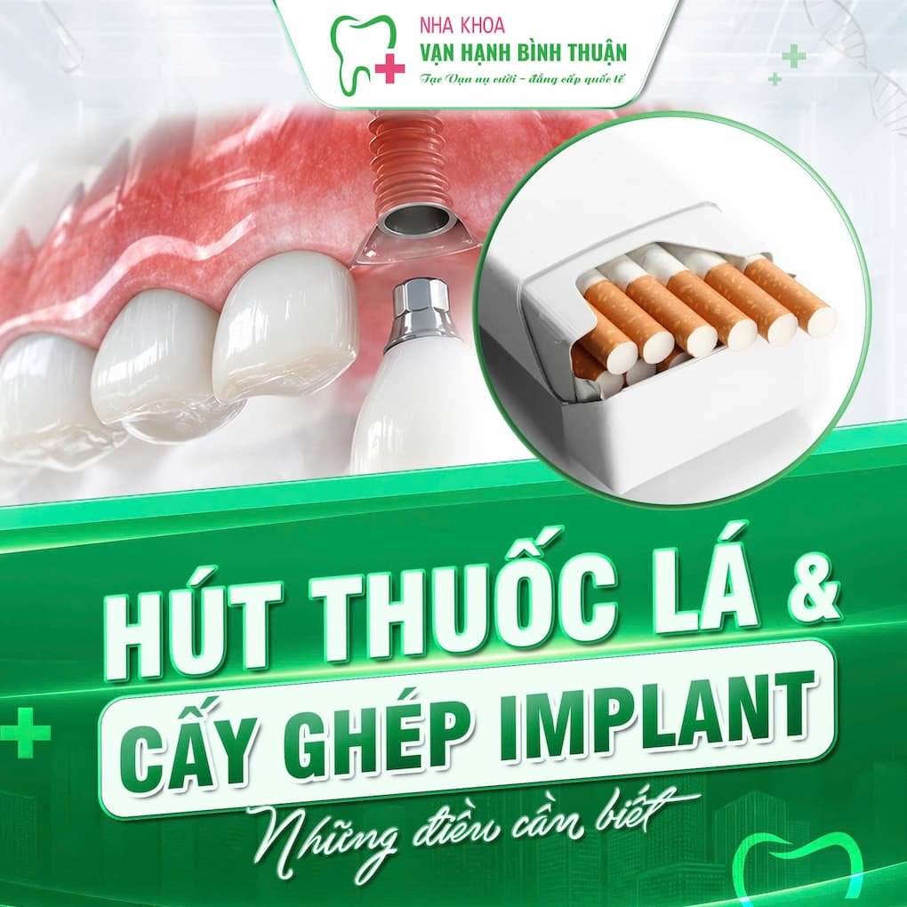 Hút thuốc lá và cấy ghép Implant