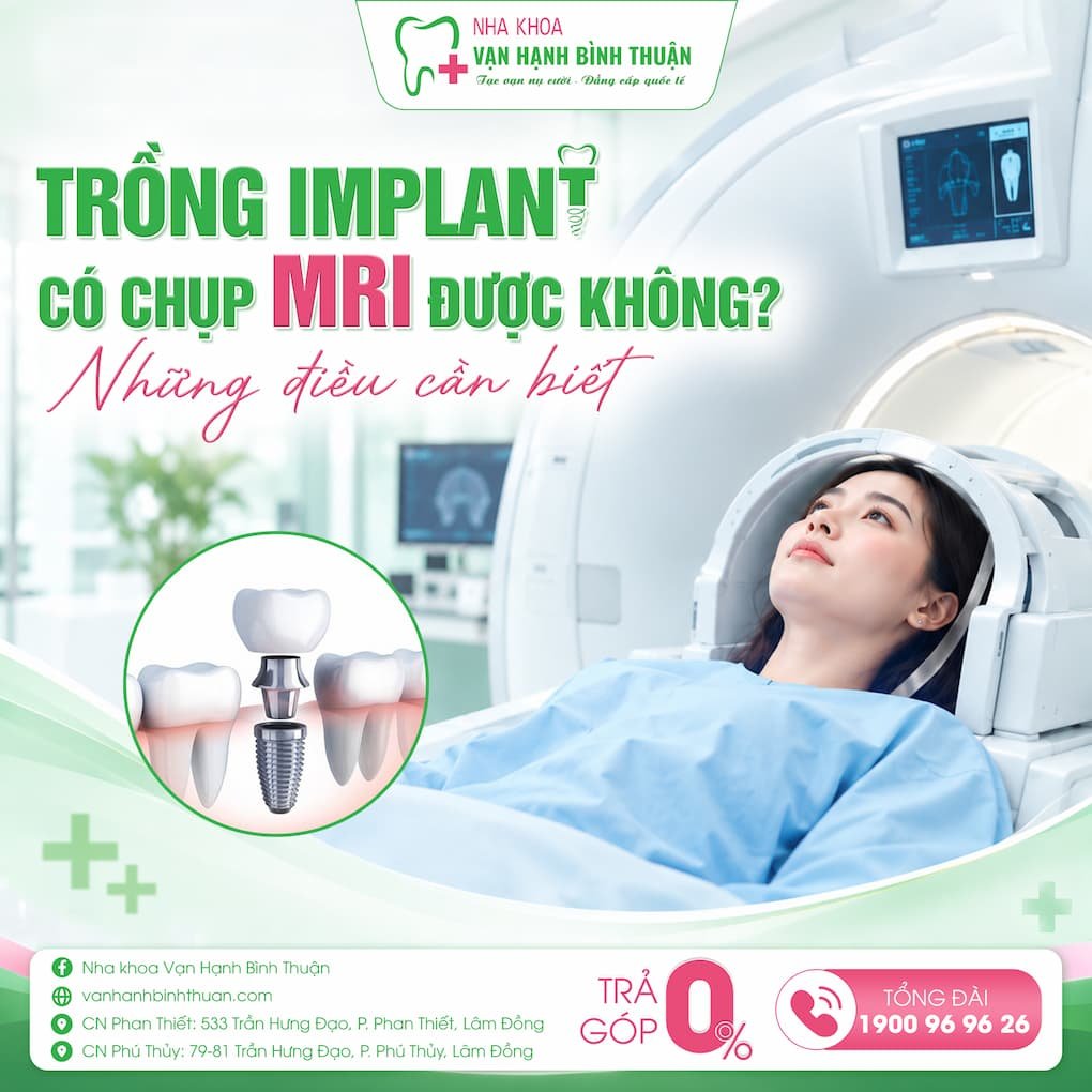 trồng implant có chụp mri được không