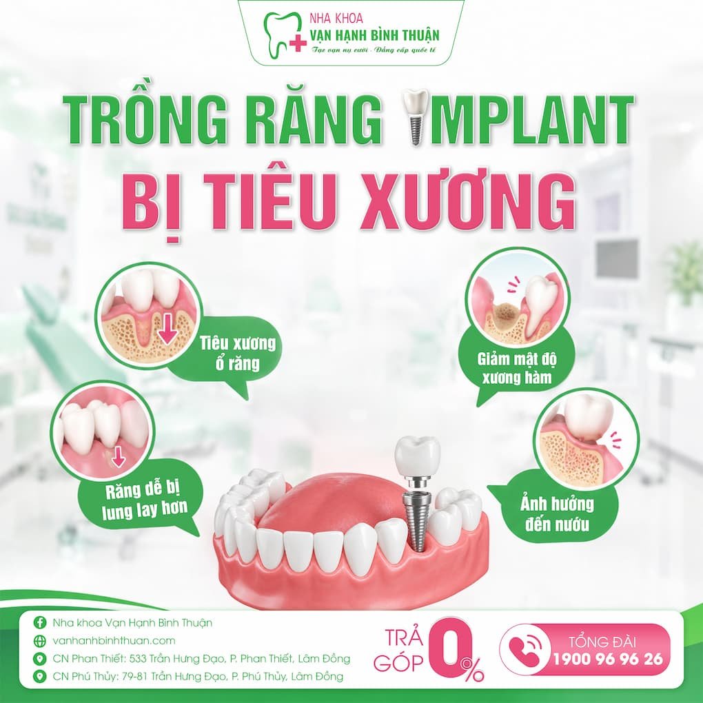 trồng răng implant bị tiêu xương