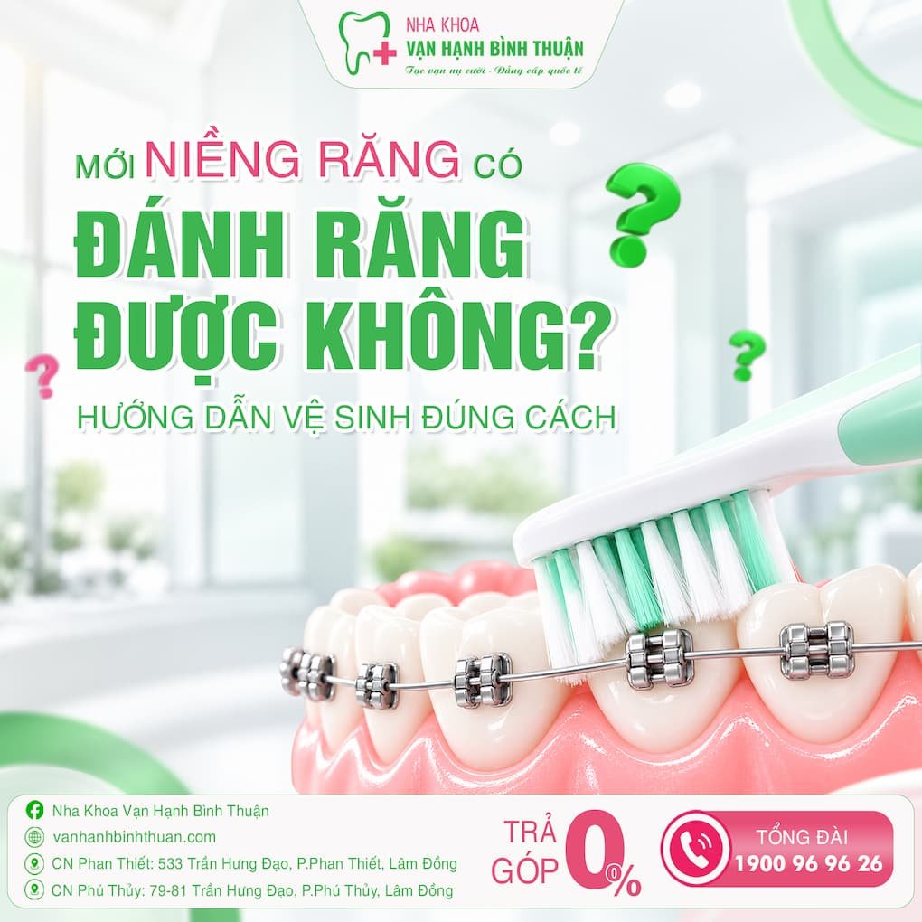 mới niềng răng có đánh răng được không