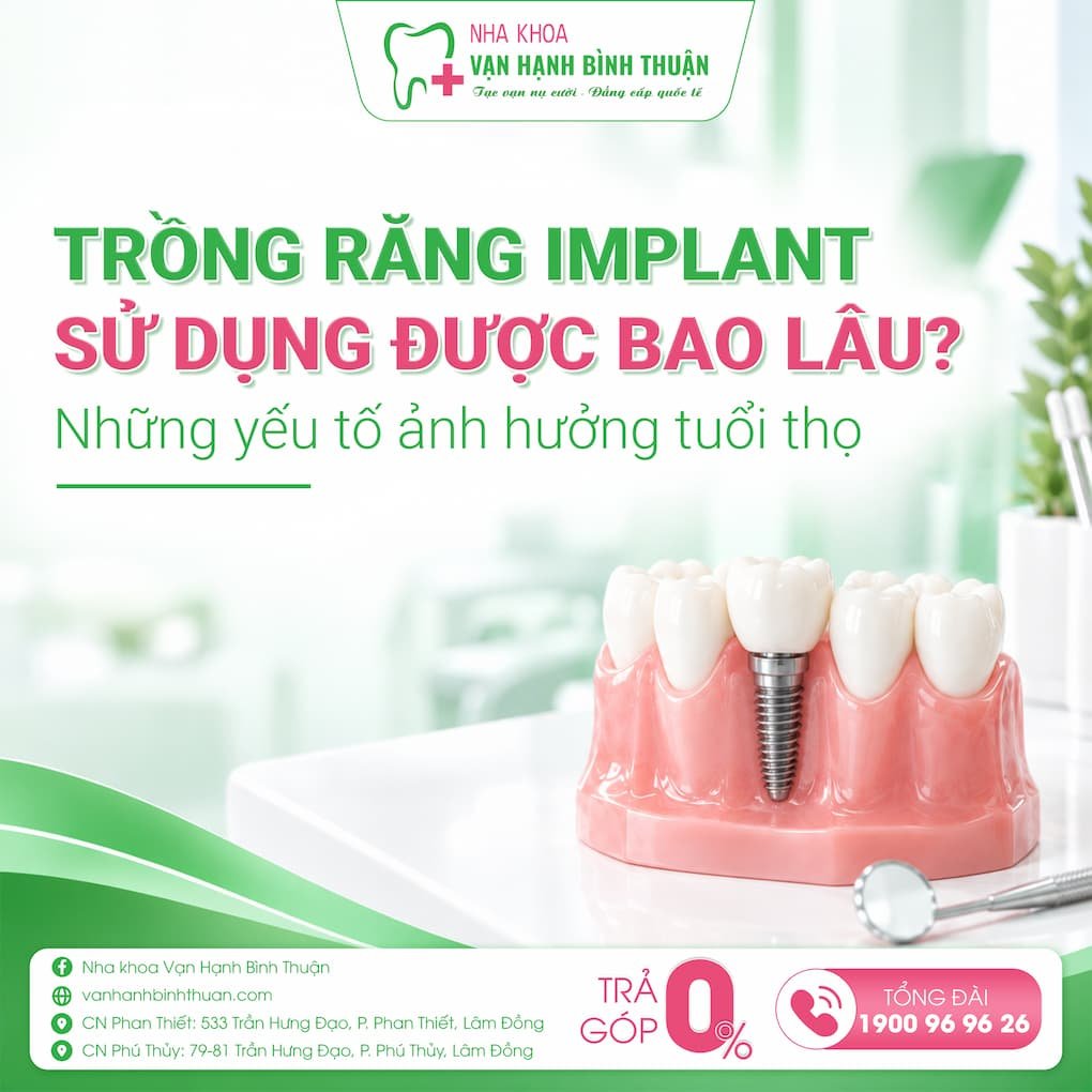 trồng răng implant sử dụng được bao lâu